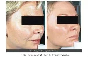 Anti-aging treatments Anti-aging treatments