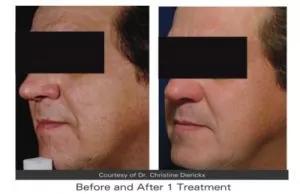 Anti-aging treatments Anti-aging treatments